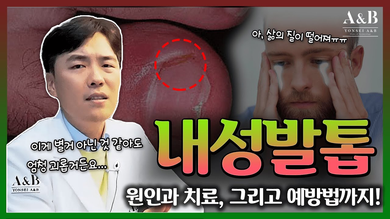 내성발톱 끝장내는 법?? / 피부과 의사가 알려드립니다 / 연세에이앤비 피부과 이해진원장