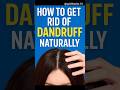 How to Get Rid of Dandruff Naturally ❄️🧴 | 3 Easy Home Remedies | QuickHacks | #shorts