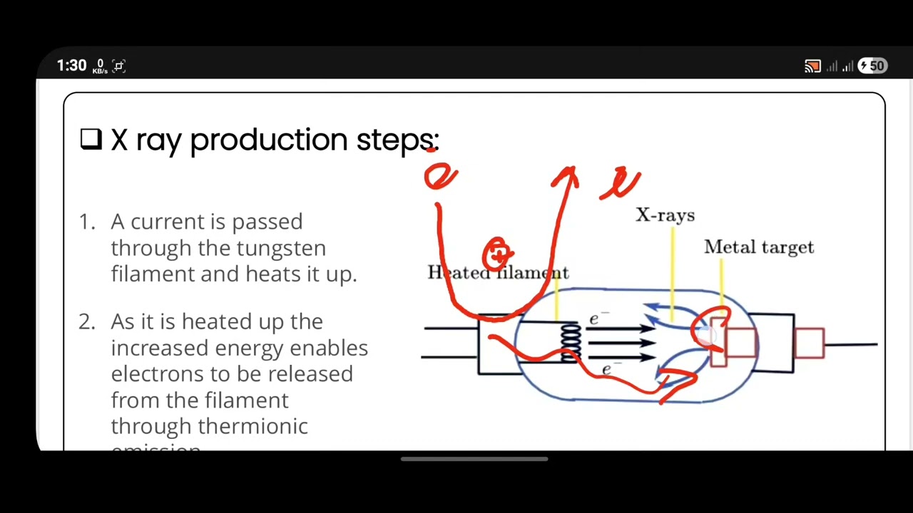 X-Ray Sec 1