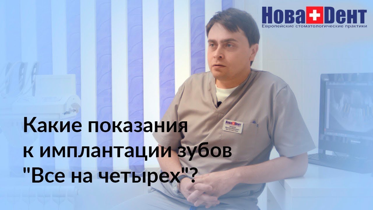 Какие показания к имплантации зубов "Все на четырех"? - YouTube