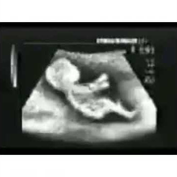Ketika anak pembalap masih dalam kandungan ibu 😅😅😅😅