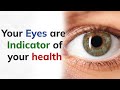 आँखो से अपनी Health के बारे में जाने | Your eyes are indicator of your health | Dr Harpreet eye care