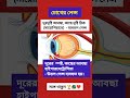 #bangali_gk মায়োপিয়া  হাইপারমেট্রোপিয়াতে - উত্তল #চোখ #লেন্স #myopia #eye_lens #short @Amitexam1