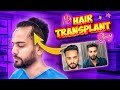 My hairtransplant journey  elvish yadav