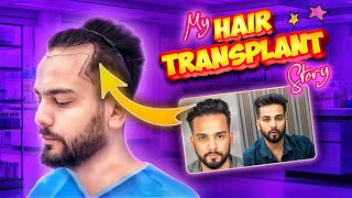 My Hairtransplant Journey - Elvish Yadav｜Elvish Yadav Vlogs