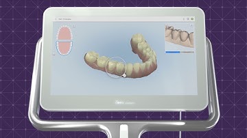 iTero Element® 2: Your Intuitive Digital Solution