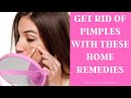 Get Rid Of Pimples With These Home Remedies | Naturesfill.com