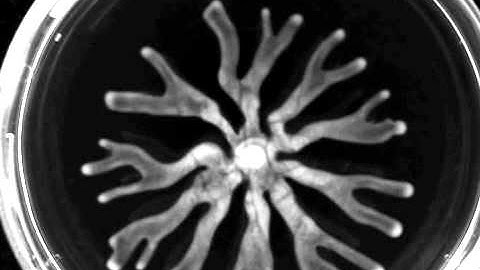 Disease-causing bacteria form swarming colony