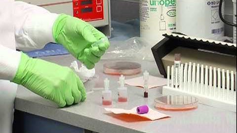 2 White Cell Count:  Diluting