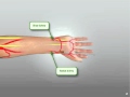 Radial Heart Catheterization.mov