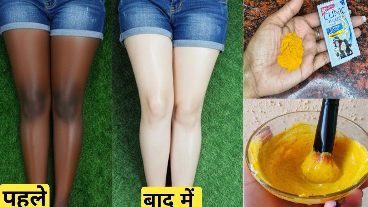 1₹ के शैम्पू में ये चीज़ मिलाकर लगा लो पैर दूध की तरह गोरे होजाएगे सब हैरान रह जाएँगे बस एक बार