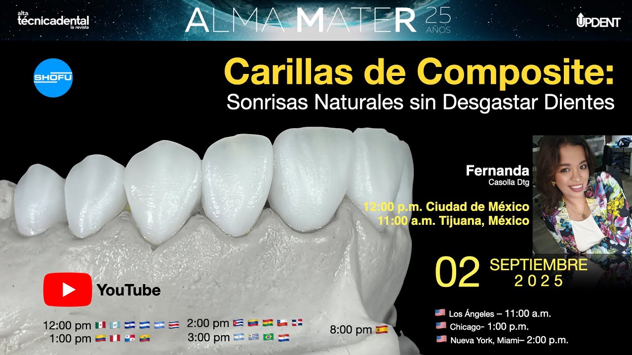 Carillas de Composite: Sonrisas Naturales sin Desgastar Dientes. Fernanda Casolla Dtg