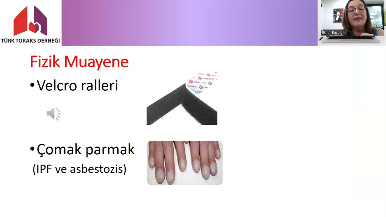 İPF Dışı İnterstisyel Akciğer Hastalıklarının Yönetimi (Sağlık Profesyonelleri İçindir)