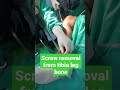 #tibia #bone#fracture #doctor #neet2023 #neetmotivation #shorts#youtubeshorts