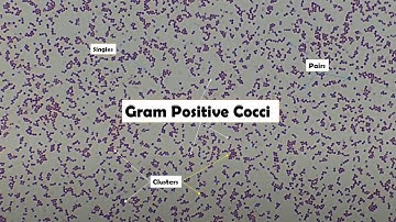 Staphylococcus aureus in Gram stained smear of culture under the Microscope at various magnification