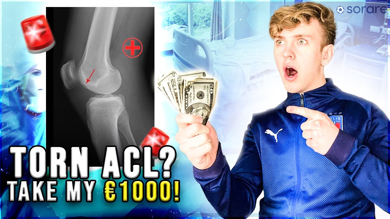 Why You Should Buy Injured Players On Sorare