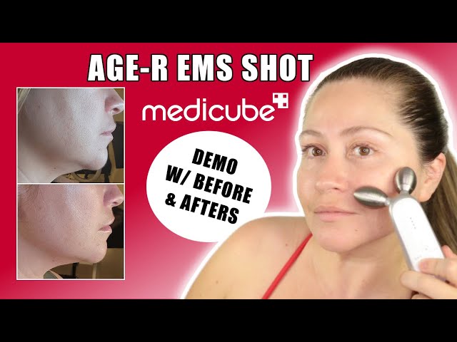MEDICUBE AGE-R EMS DERMA SHOT DEVICE| 2 MONTHS RESULTS| DEMO AND