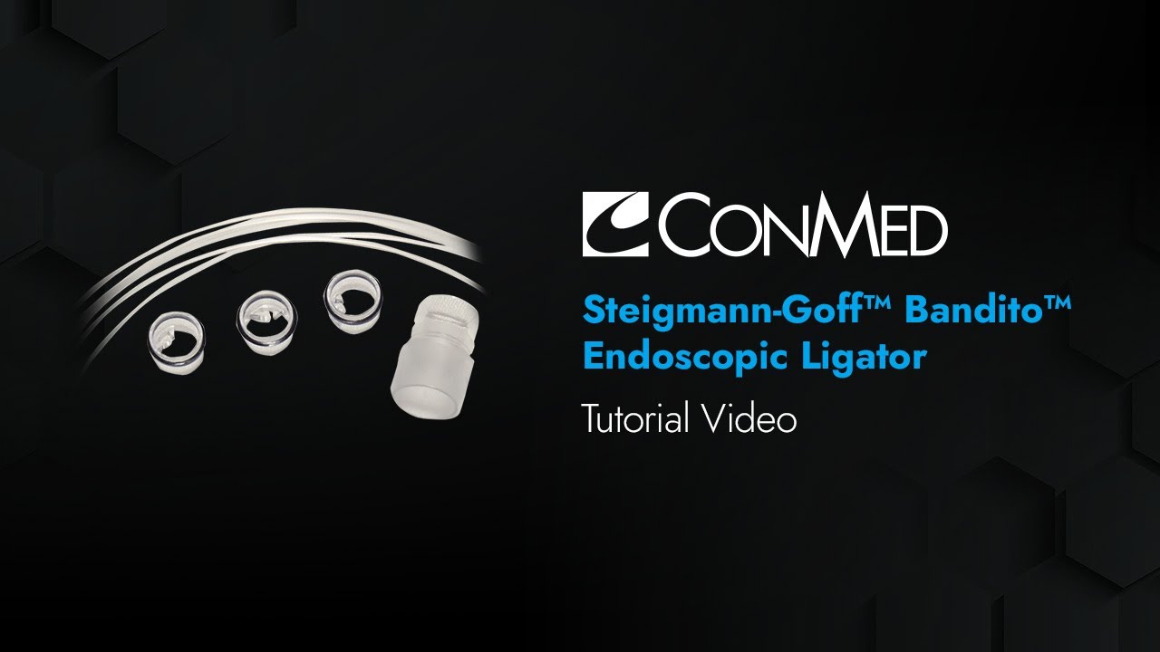 Essential Skills for Using the SteigmannGoff® Bandito® Endoscopic