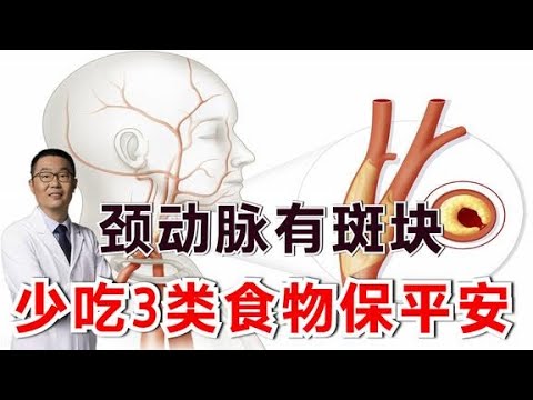 有颈动脉斑块，少吃3类食物！医生提醒：同时注意3种治疗方案
