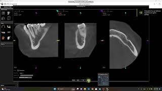 ازاي افتح الحالة من على ال CD جاي من سوفتوير كيرستريم؟ screenshot 3