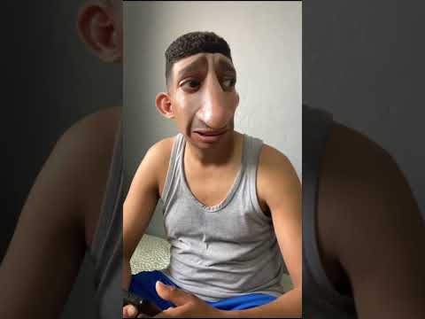 فاش كتشوهك مك