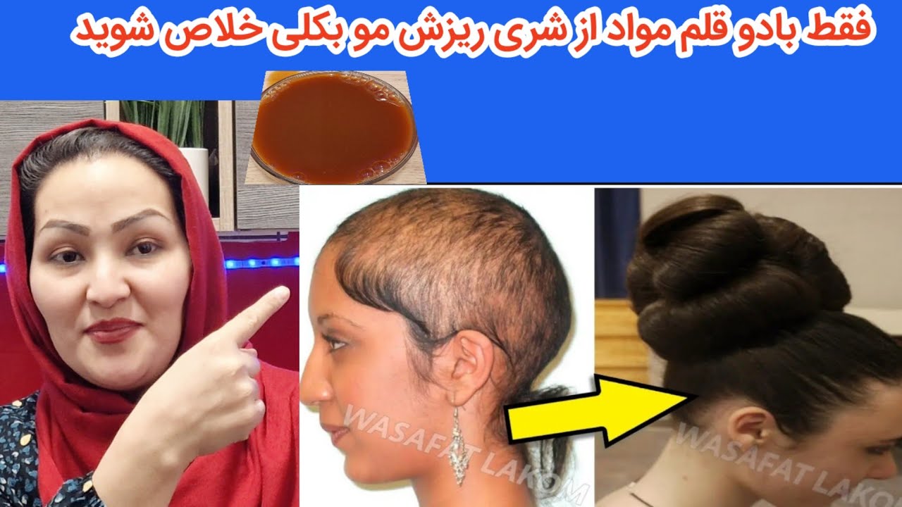 میخواهید با دو قلم مواد از شری ريزش مو هایتان خلاص شوید ✅️💯👌