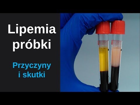 Lipemia (zmętnienie) próbki -Co znaczy surowica lipemiczna? | Lipemia turbidity sample lipemic serum