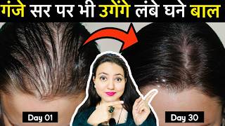 30 Days Challenge Hair Wash करन स 30 मनट पहल Use कर, पए Long,Thick & Extreme Hair Growth