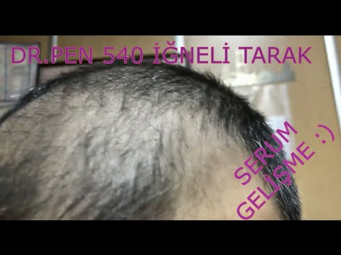 Dermaroller 540 iğneli titanyum saç çıkarma tarağı #saçlosyonu#saçtarak#saçserumu#maviserum