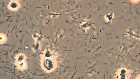 Spirochetes Attacking White Blood Cells in Mouth