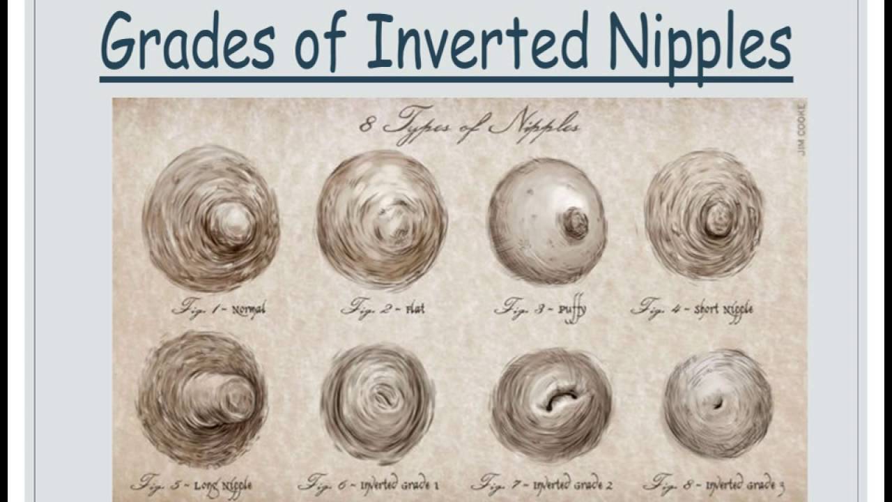 Inverted Nipples Definition – BirthForMen