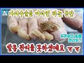 다리수술을 여러번 발톱관리 하기가 힘들었다는 연세많으신분 발톱이 너무 길어져 불편하셨는데 안아플만큼만 제거하기 fungus toenail removal [푸스올영등포당산점]