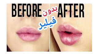 #تكبير#الشفاه-في 5 دقائق وبدون فيلر#Lip augmentation without fillers#