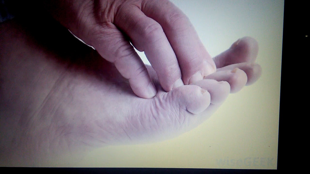 How To Stop Itching Feet Fast How To Cure Athlet YouTube