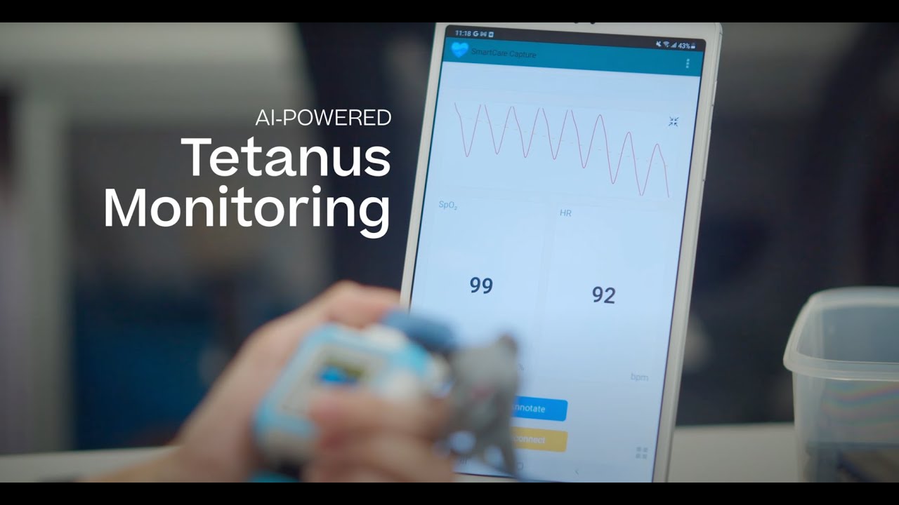 AI and Wearable Tech for ICU Care in Low-Resources Settings | Research Explainer (Full)