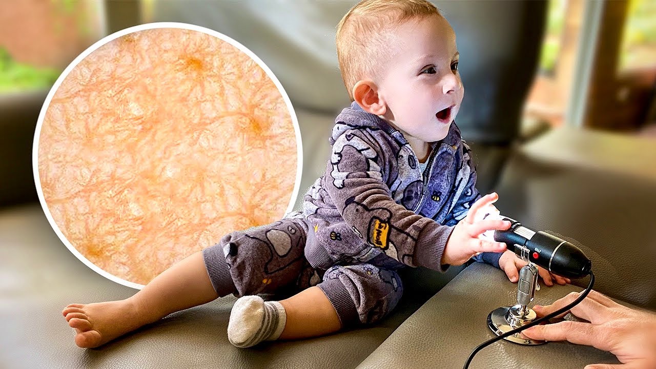 COLOQUEI A MÃO DO GAEL NO MICROSCÓPIO X1000!