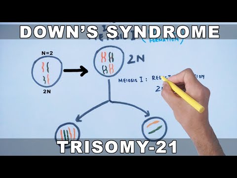 Video: Ce merge prost în sindromul meioză Down?