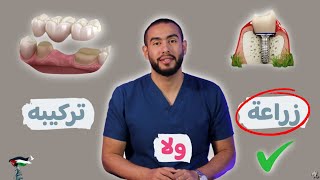 تعمل زراعة لأسنانك ولا تركيبة ثابته ايهما افضل | عيوب زراعة الاسنان | تكلفة زراعة الاسنان