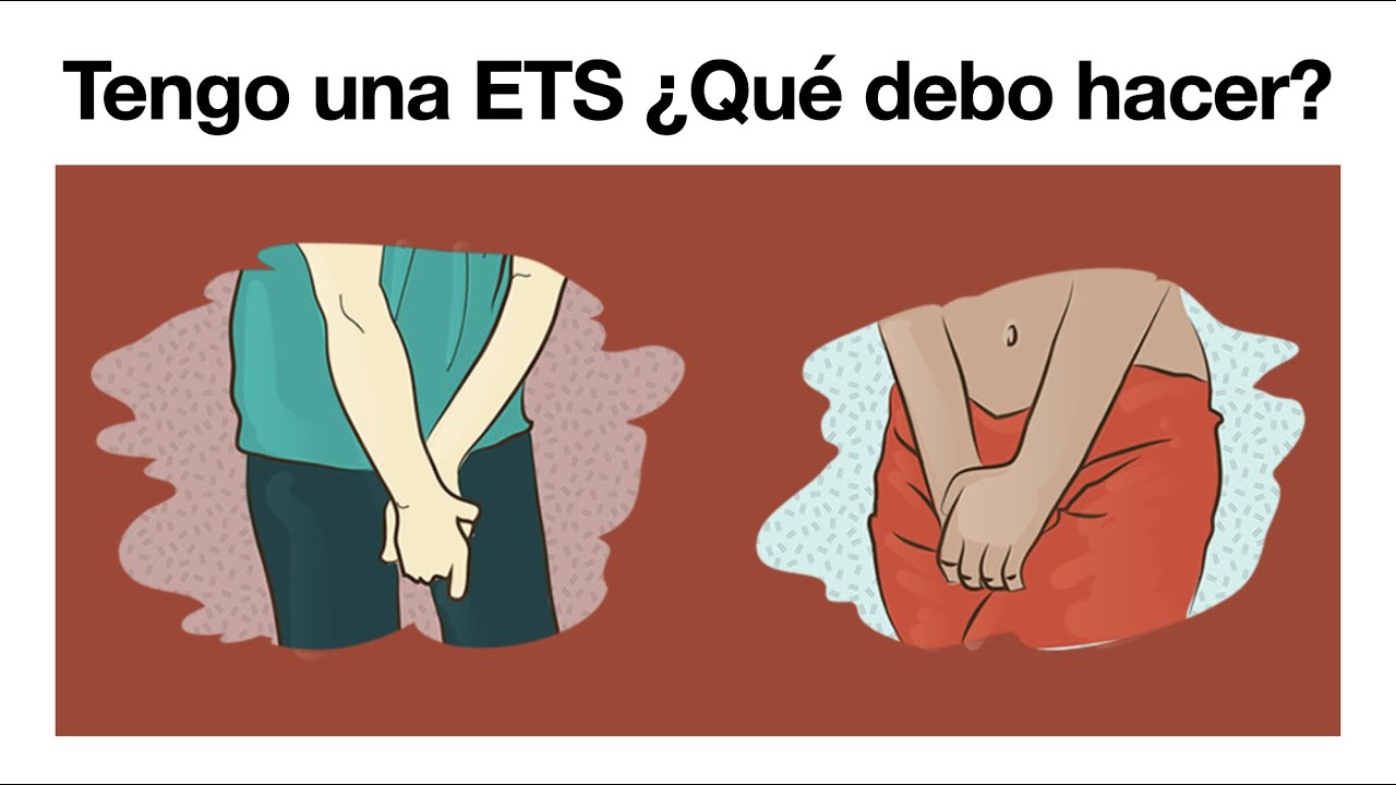 tengo-una-ets-qu-debo-hacer-enfermedades-de-transmisi-n-sexual