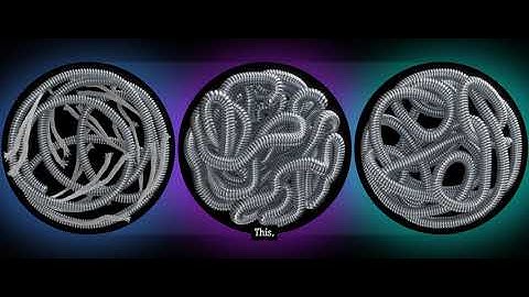 Simple by Design: EMBOLD™ Detachable Coil System for Versatile Embolization