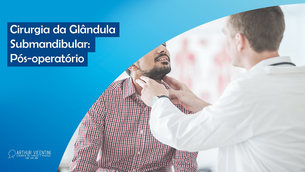 Cirurgia da Glândula Submandibular: Pós-operatório | Dr. Arthur Vicentini CRM 154.086