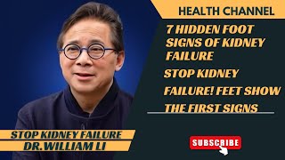 7 TOXIC Signs of Kidney Failure In Your Feet! No  5 Is SNEAKY! DR.WILLIAM LI
