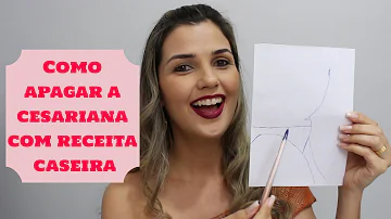 O que passar no corte da cesárea?