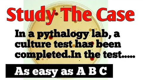 HOW TO SOLVE CASE BASED QUESTION ? ITS AS EASY AS 👉A 👉B👉C