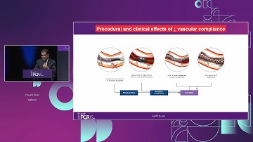 OCT-guided PCI for a patient with calcified lesion - GulfPCR-GIM 2023
