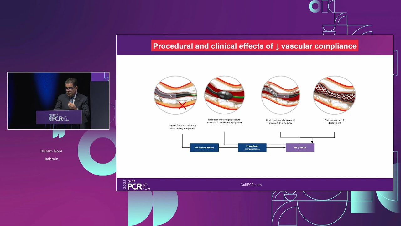 OCT-guided PCI for a patient with calcified lesion - GulfPCR-GIM 2023