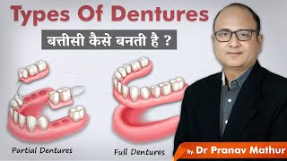 How are dentures made? Types of dentures screenshot 5