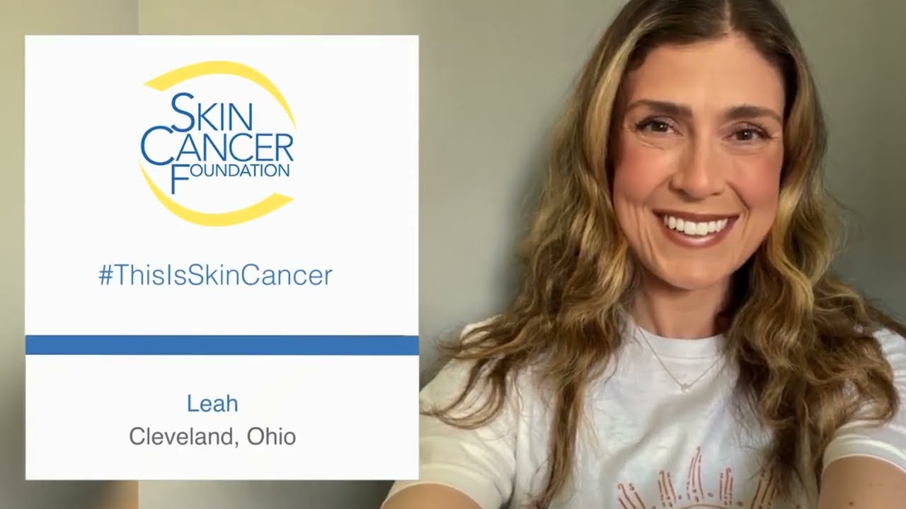 Histórias #ThisIsSkinCancer - The Skin Cancer Foundation