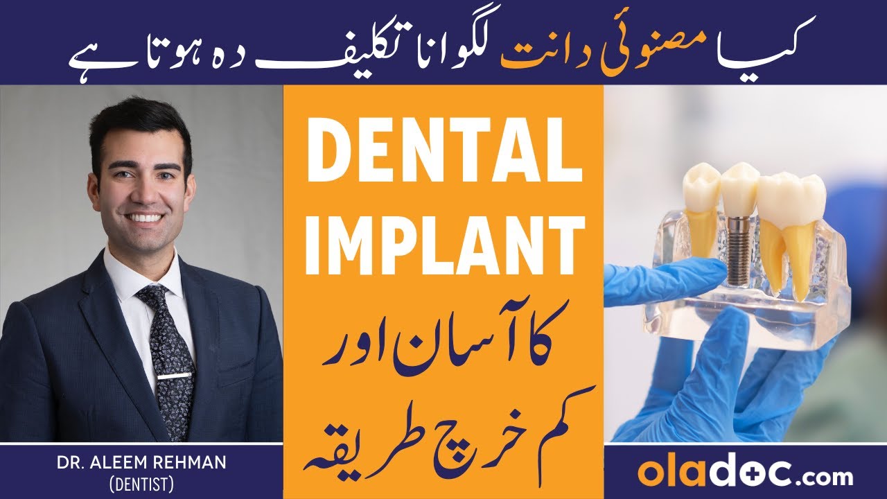 Dental Implant & Care In Urdu - Kya Naqli Dant Lagwane Chahiye? - Dental Implants Cost & Procedure