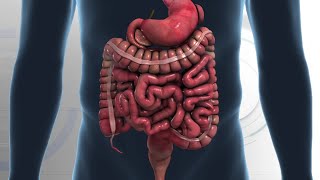 Antibiotics could be used to treat patients with appendicitis
